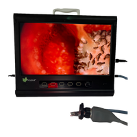 Thumbnail for Sistema de Video Endoscópico 19¨ - Viztrol - Equipo Medico para Minima Invasion