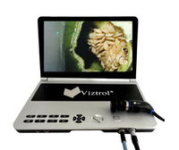 Thumbnail for Sistema de Video Endoscópico Ultraligero - Viztrol - Equipo Medico para Minima Invasion